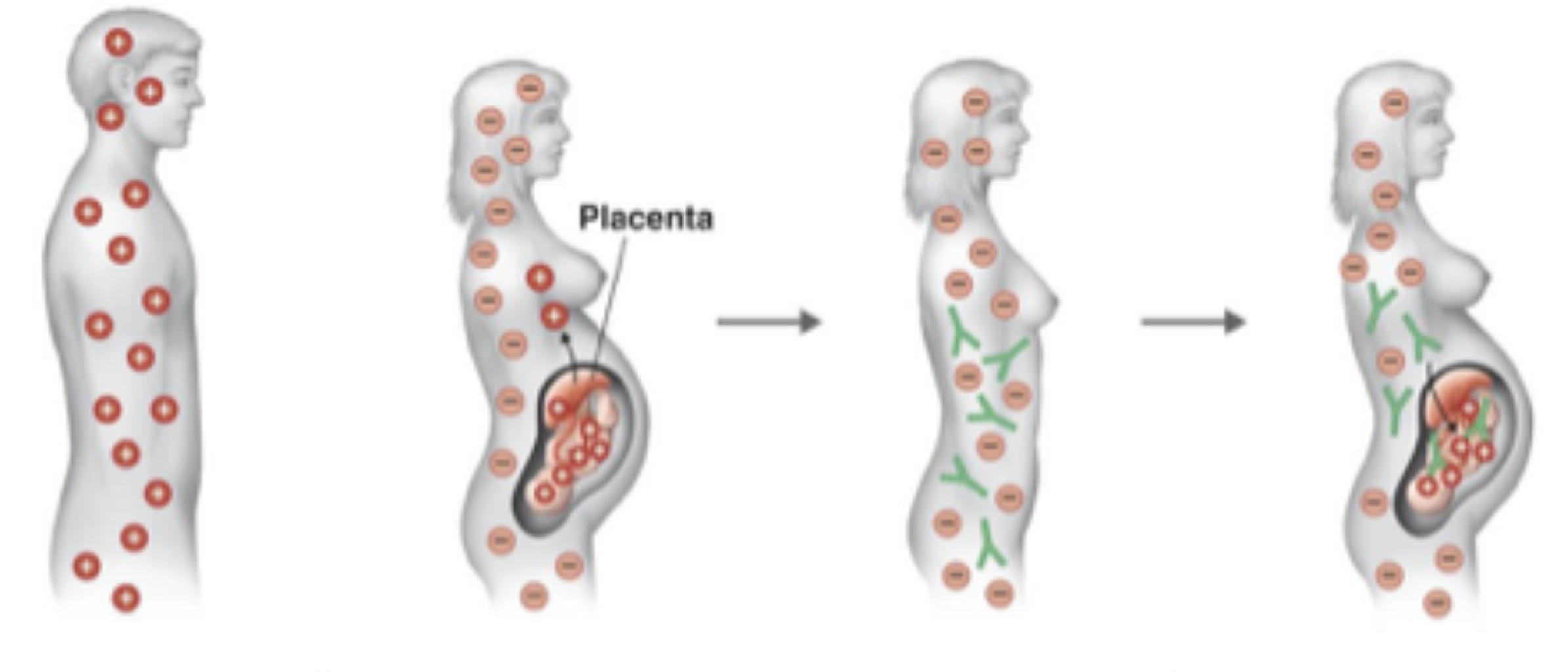 Qan Uyğunsuzluğu: Orqan Transplantasiyası və Hamiləlikdə Risklər