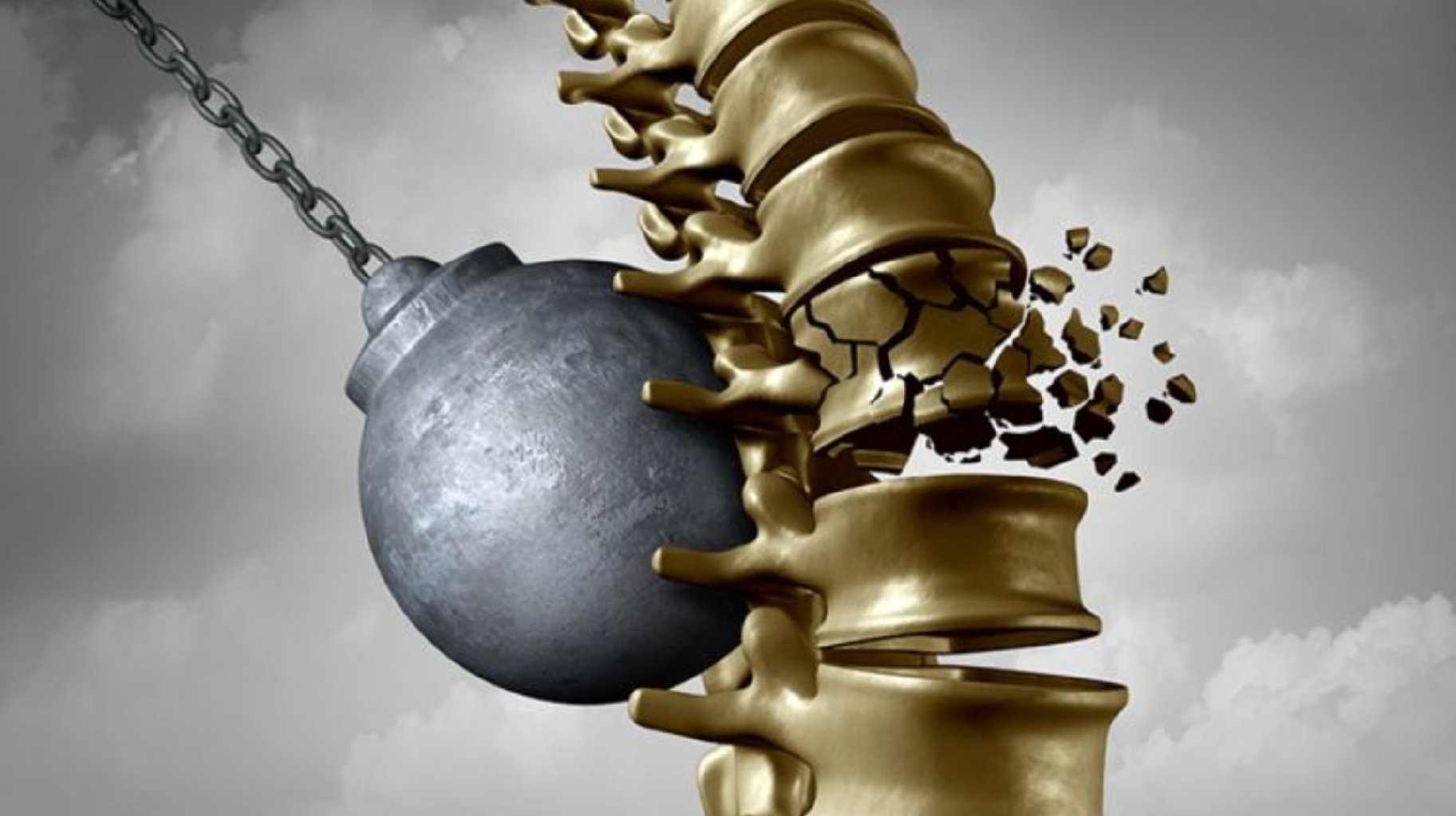 Osteoporozun (sümük kütləsinin azalması), osteonekrozların (AVN) diaqnostika və müalicəsi