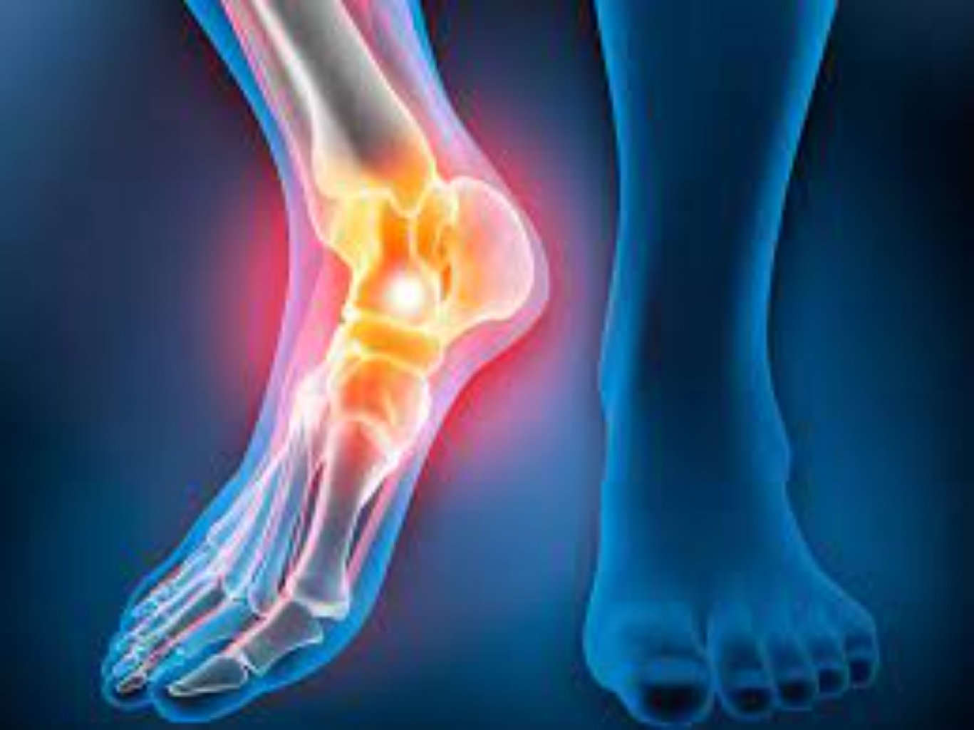 Aşıq baldir oynaginin artrozu