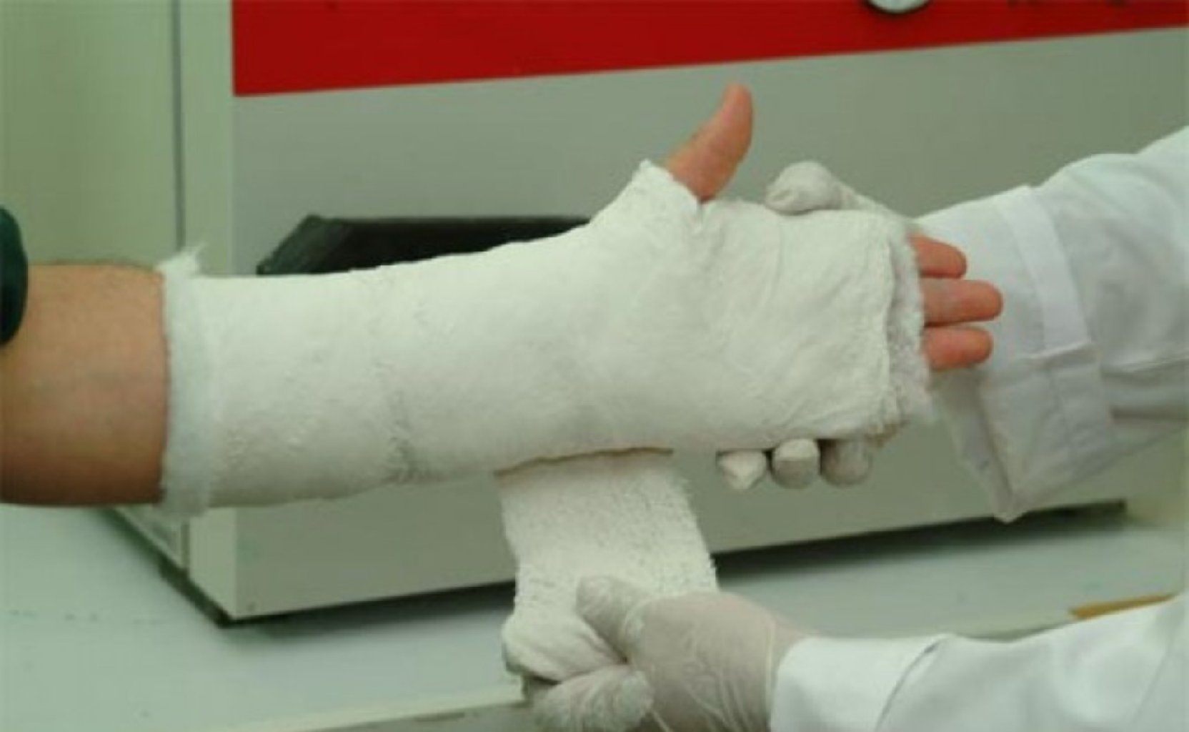 Gips və plastik sarğıların, ortezlərın qoyulması