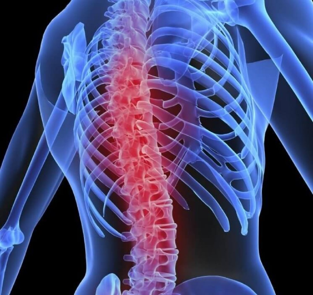 Onurganin inkisaf anomaliyalari