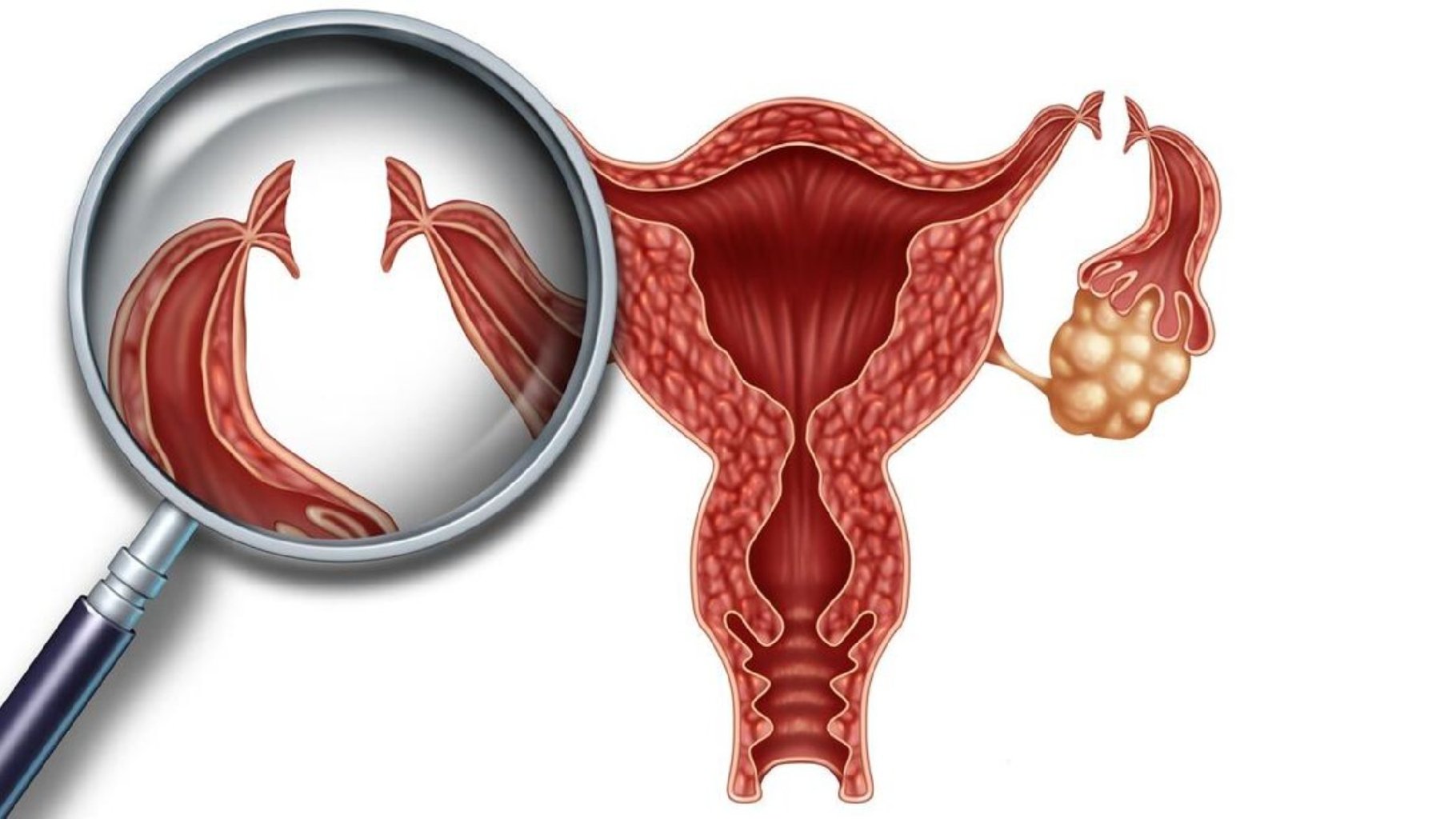 Ginekoloji erkən diaqnoz