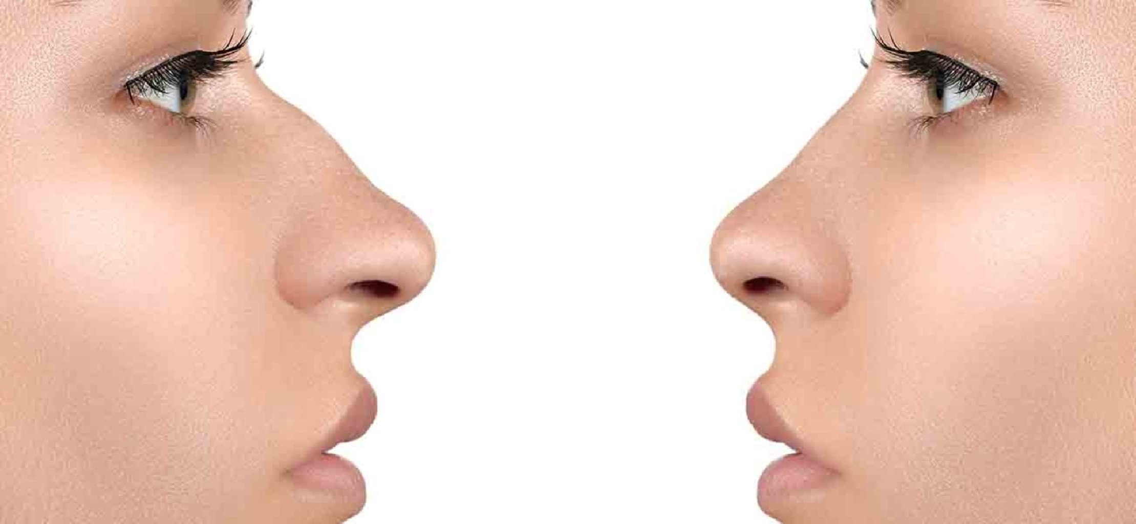 Estetik Burun Cərrahiyyəsi: Yenidən Formalaşdırma və Sağaltma Sənəti