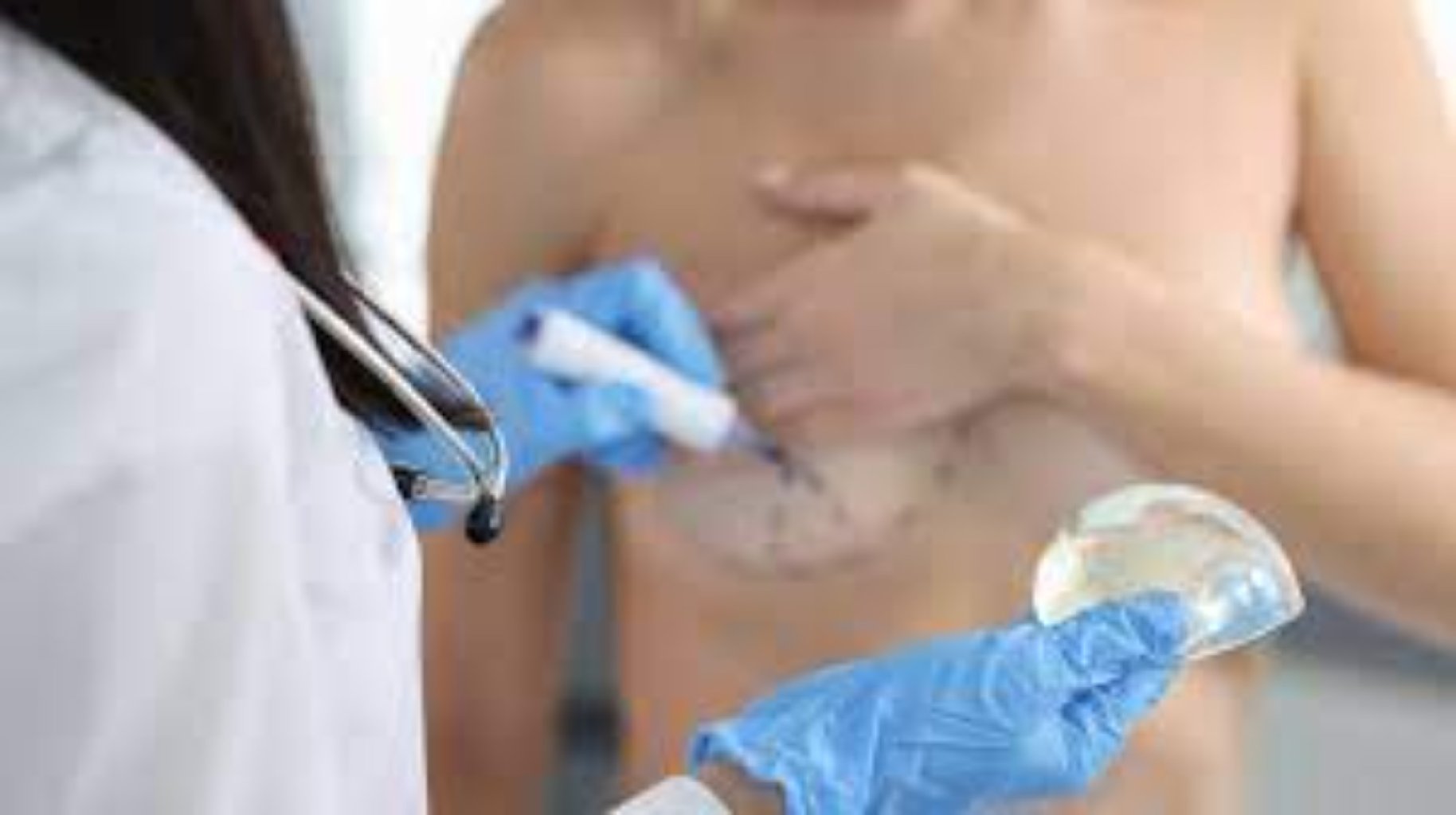 Döş Bərpası Cərrahiyyəsi