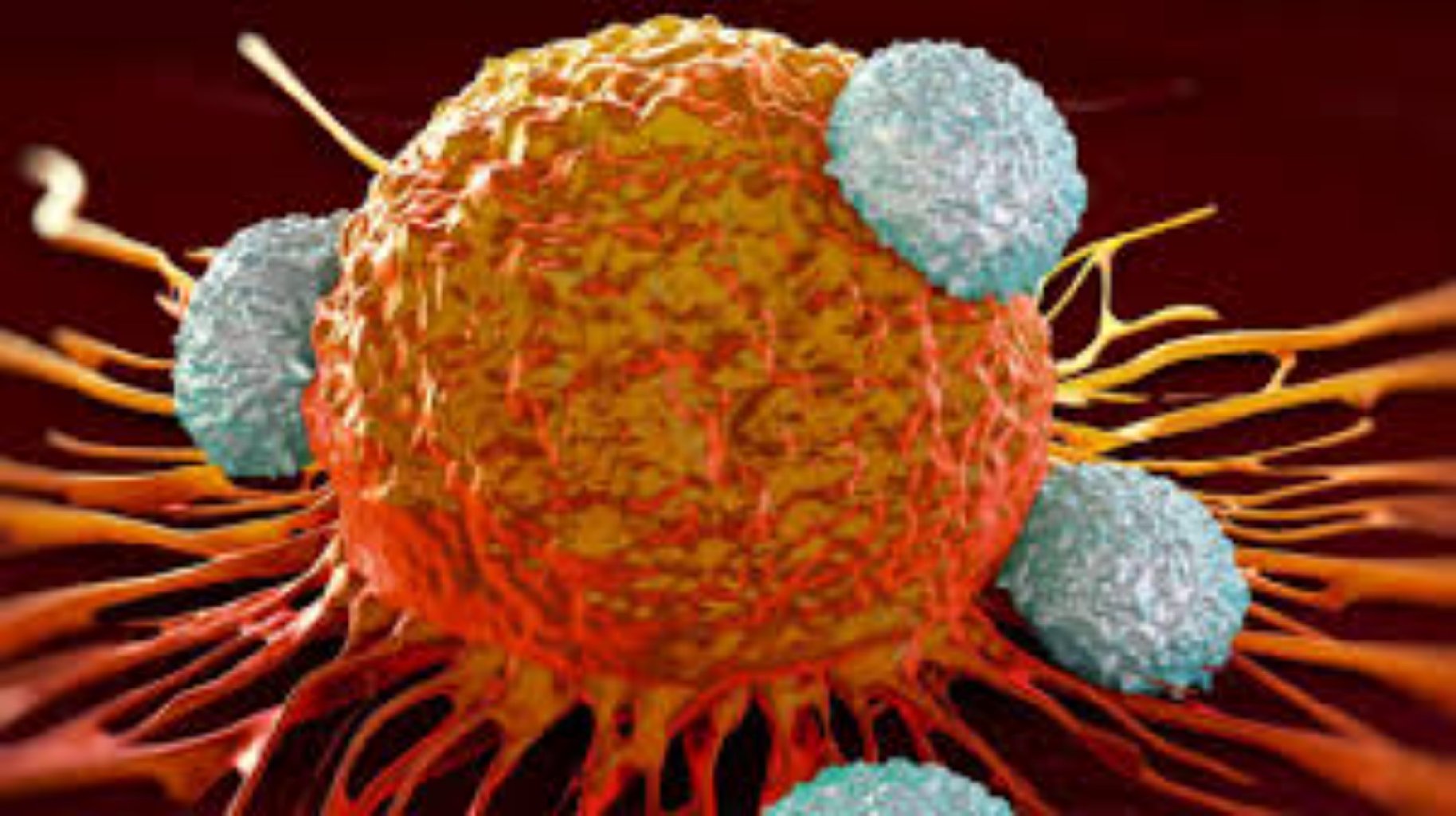 Xərçəng xəstəliyinin ağrıları