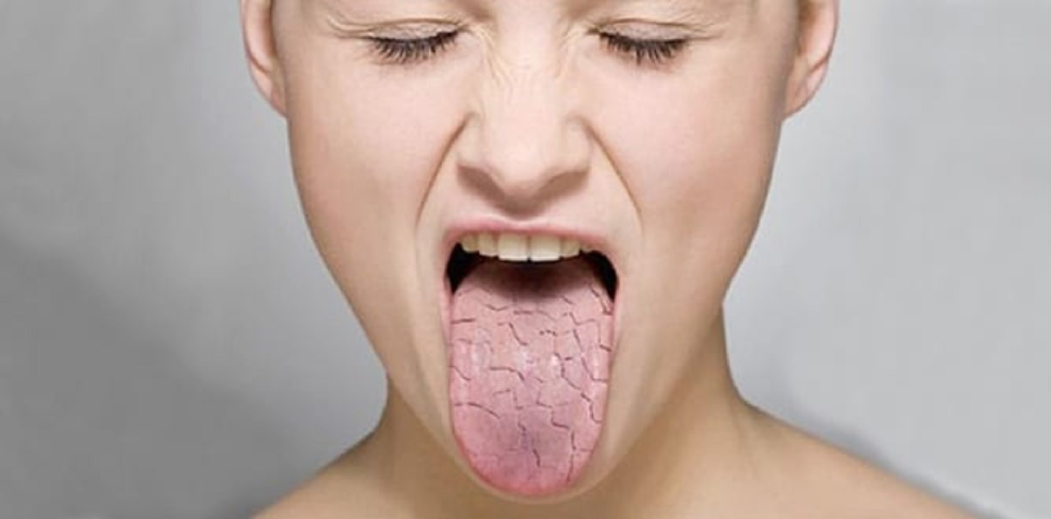 Sjögren sindromu: səbəbləri, simptomları və müalicə variantları