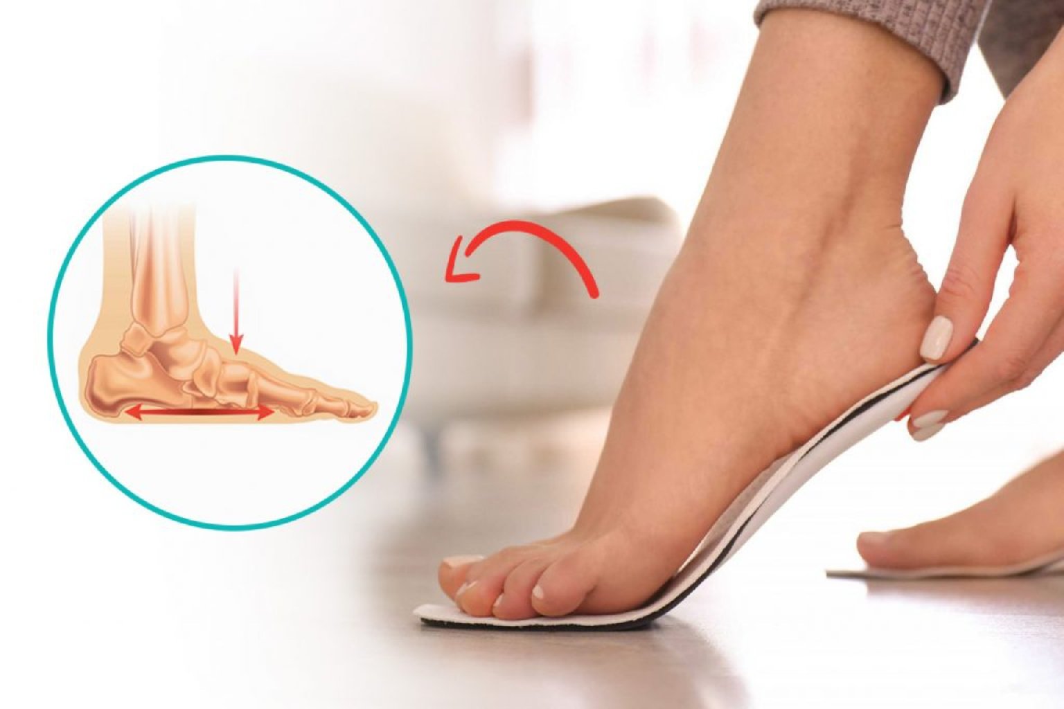 Düzdabanlıq nədir?