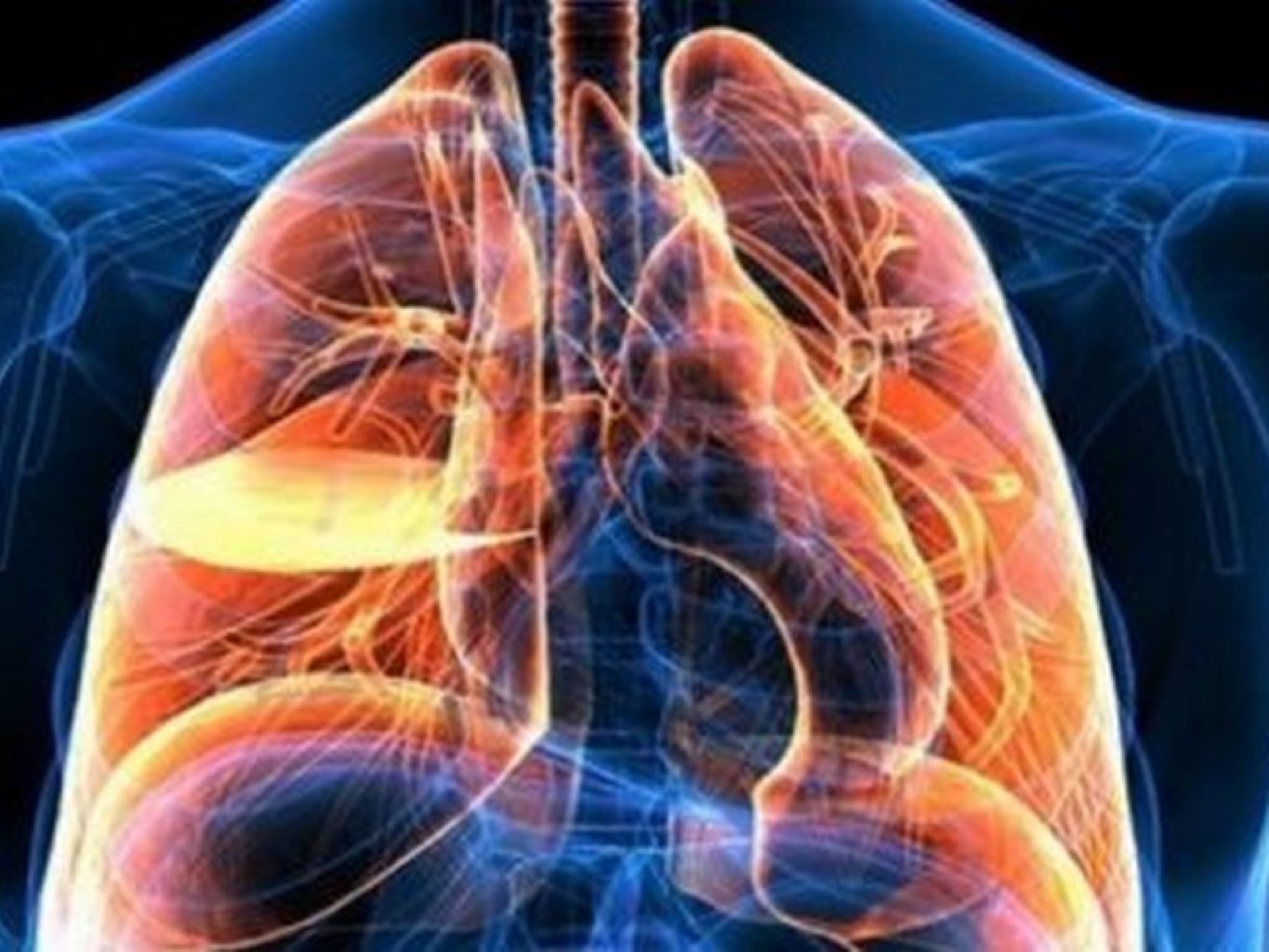 Ağciyər kistaları və müalicəsi