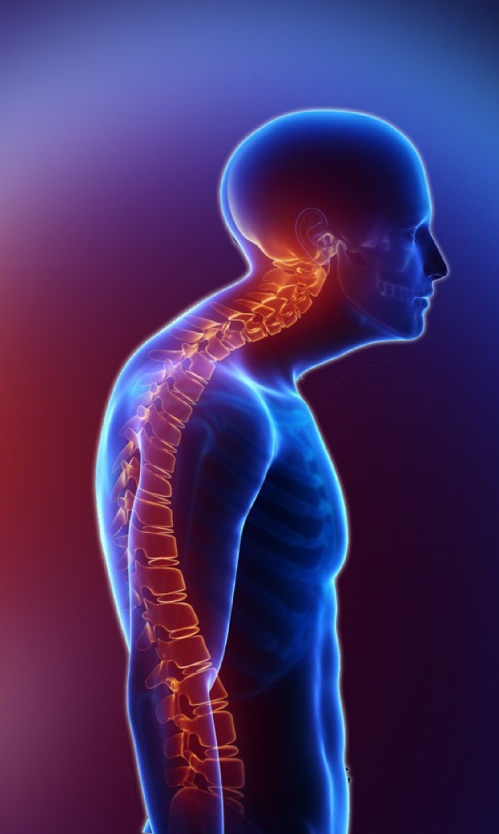 Kifoz: simptomlar, səbəblər və müalicə