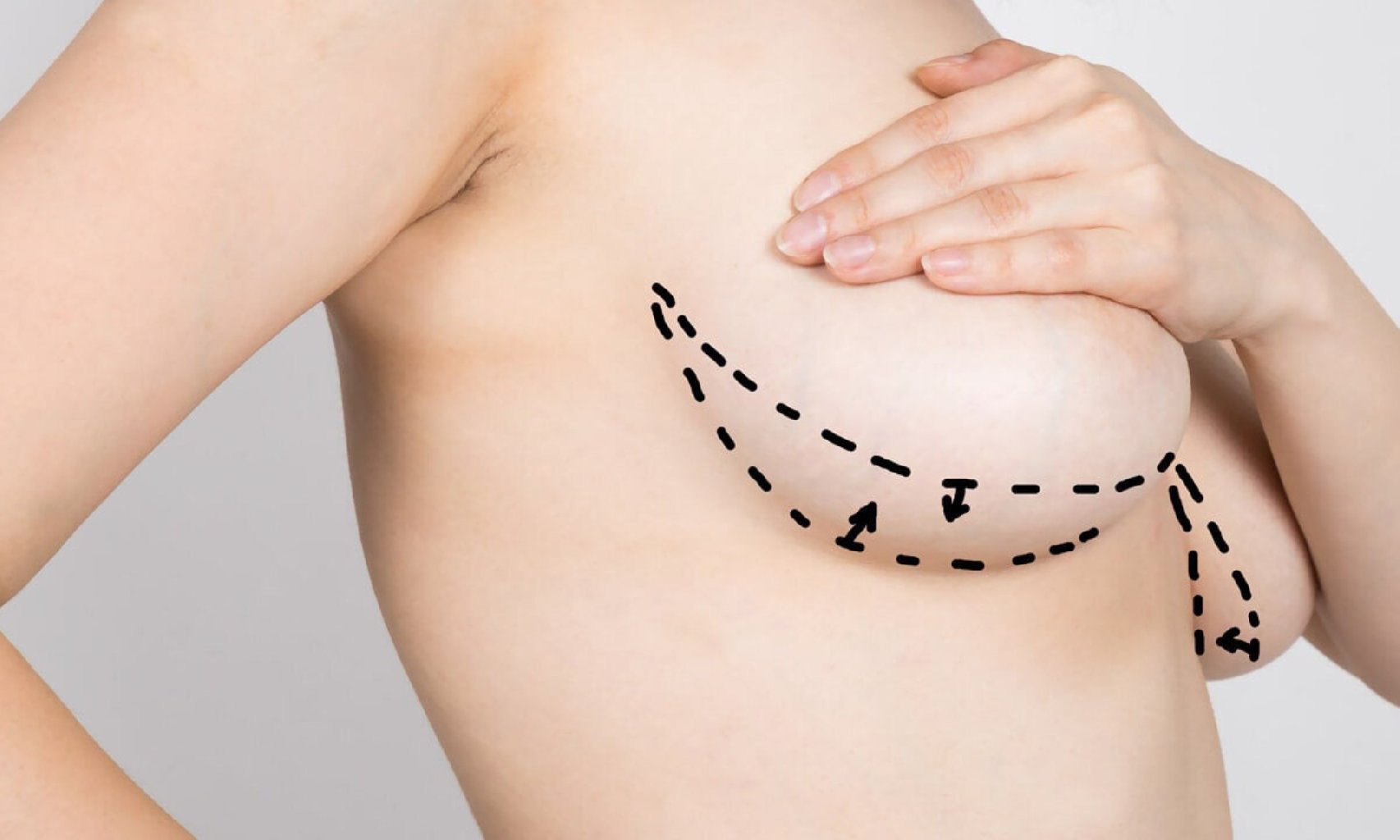 Döş kiçiltmə estetikasının sosial həyata təsirləri