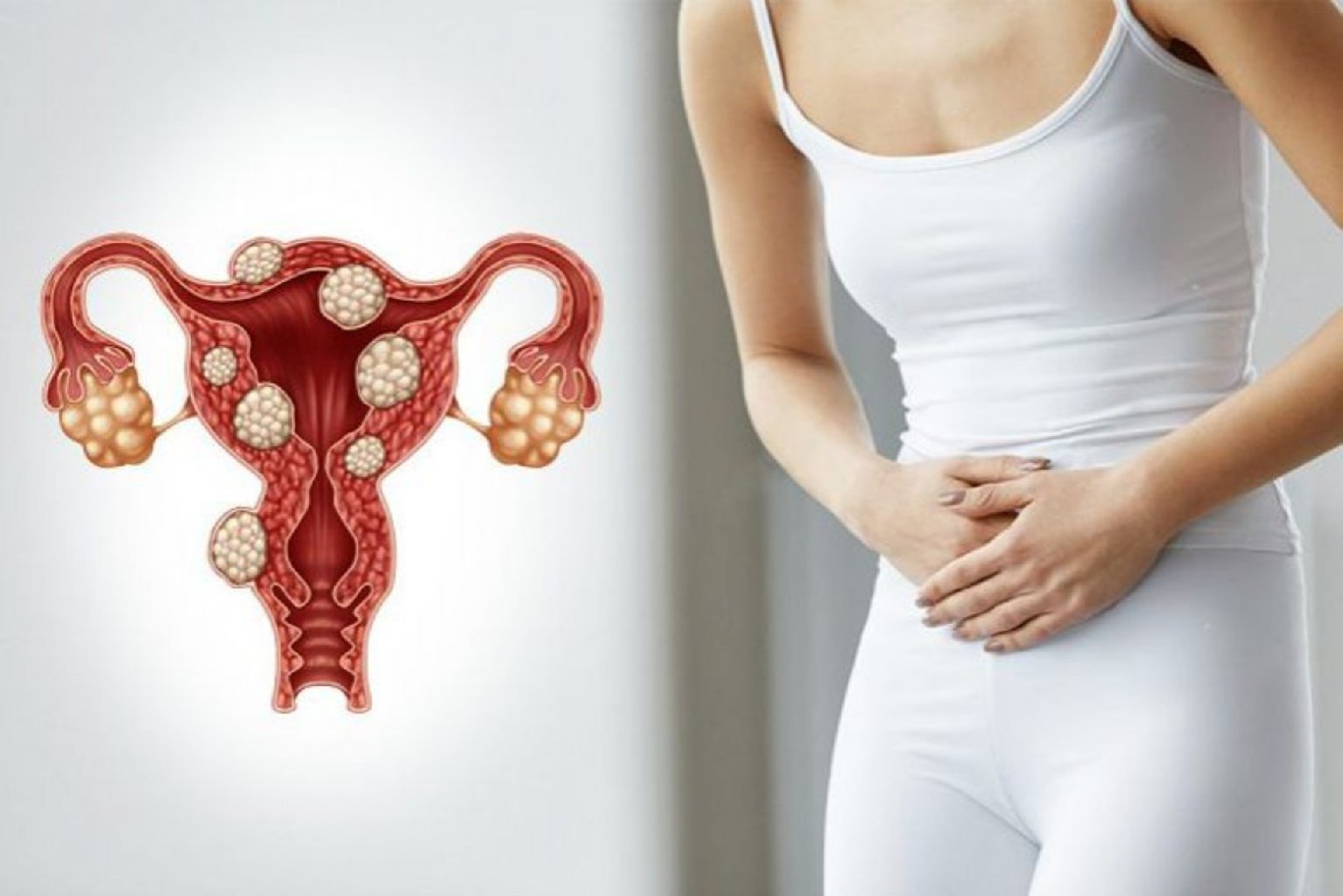 Uşaqlıq miomaları