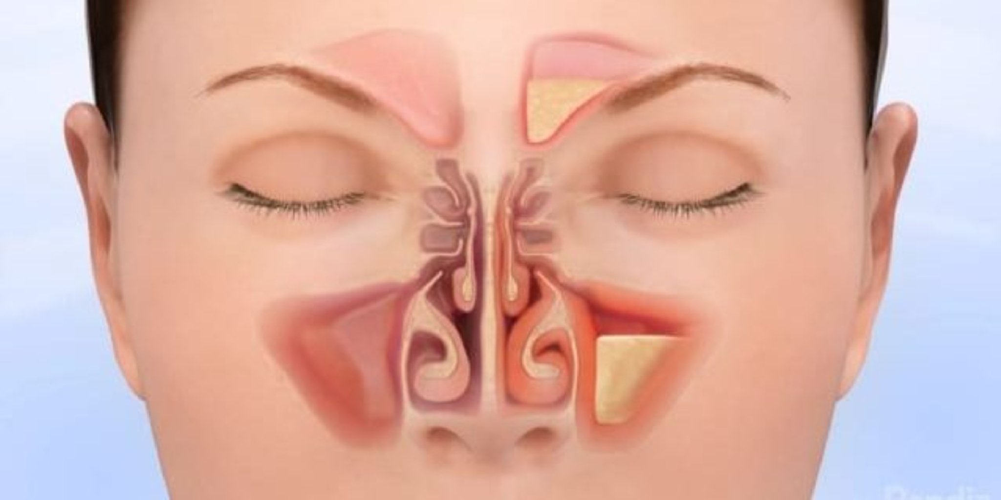 Rinologiya: Burun və Sinus Sağlamlığı Elmı