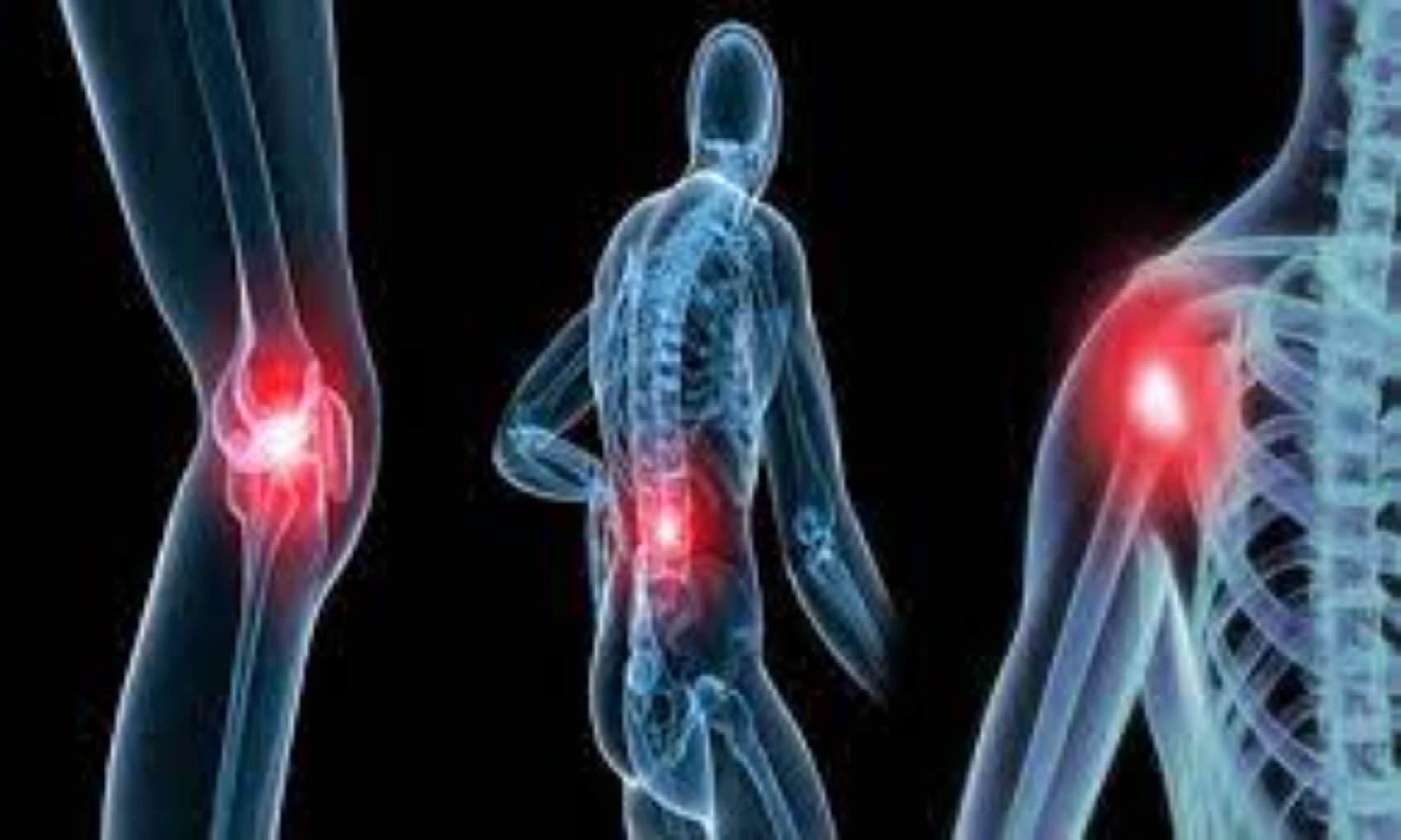 Qidalanma ve Revmatoloji xəstəliklər