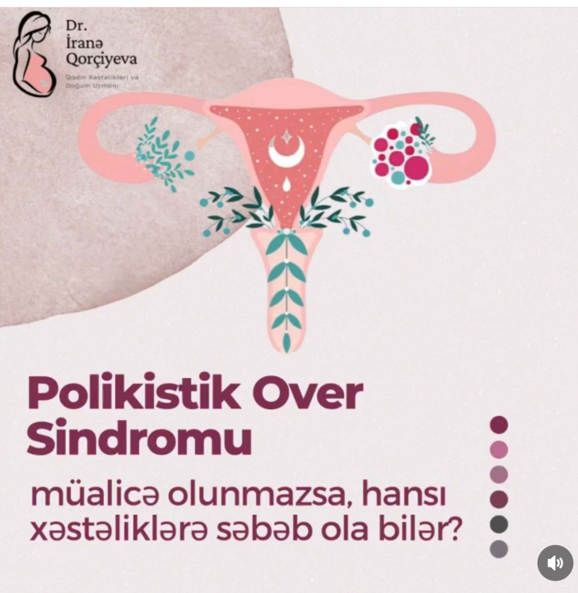 Polikistik Over Sindromu Müalicə Olunmazsa Hansı Xəstəliklərə Yol Açabilər? makalesi