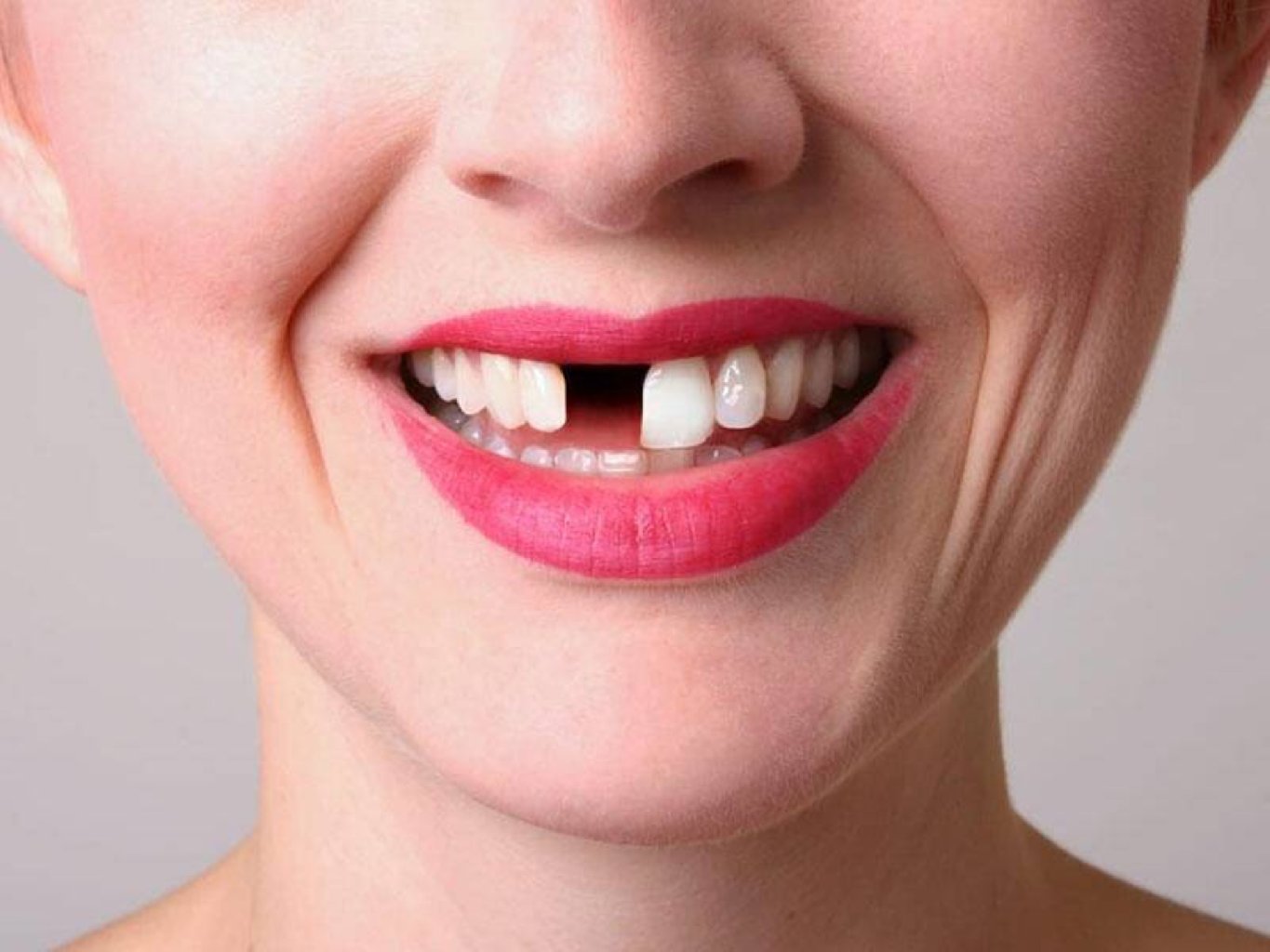 Adentiyanın qarşısını necə almaq mümkündür?