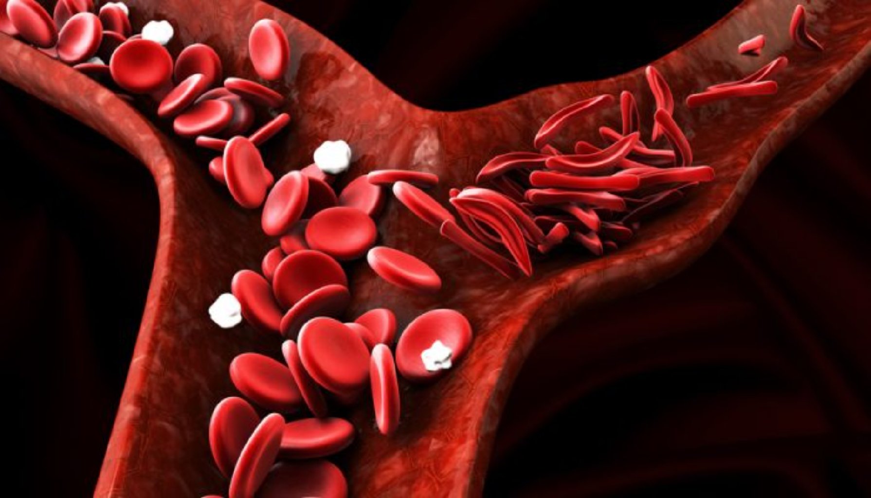 damar tutulması ilə bağlı ağrılar (vaskulitlərdə)