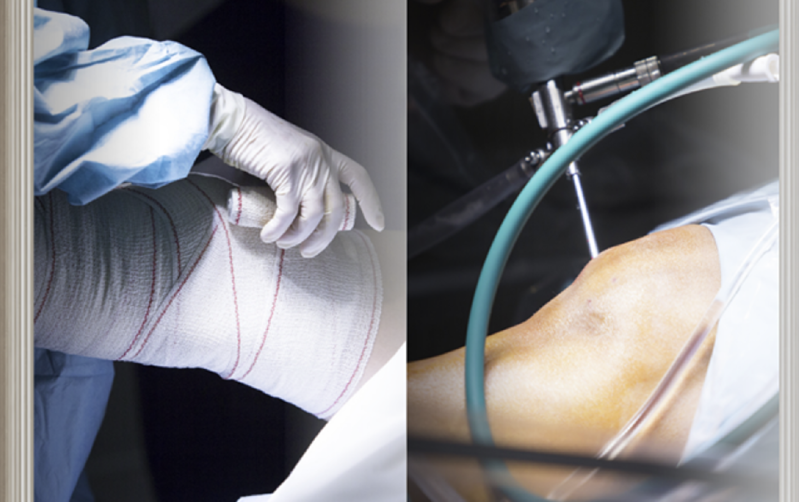 Artrozların (oynaqların duzlaşması) konservativ və cərrahi müalicəsi