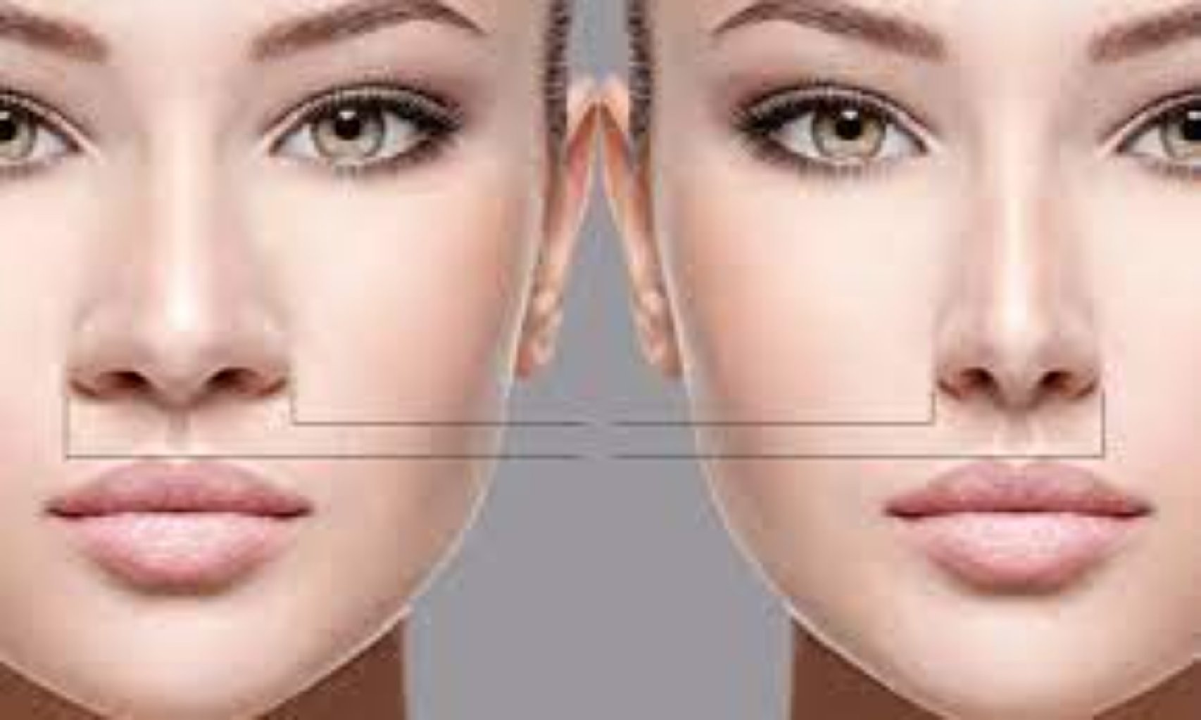 Burun Estetikası - Rinoplasti