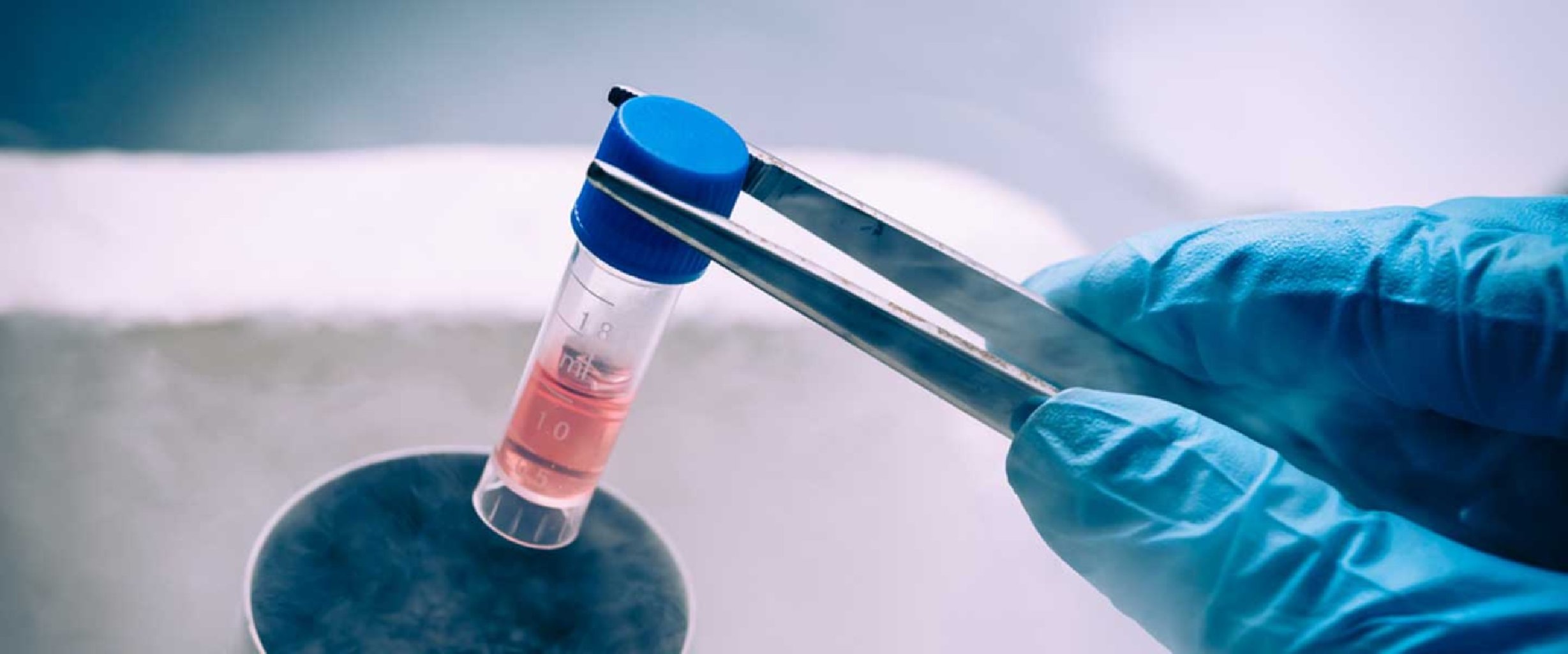 Kök Hüceyre Müaciləsi