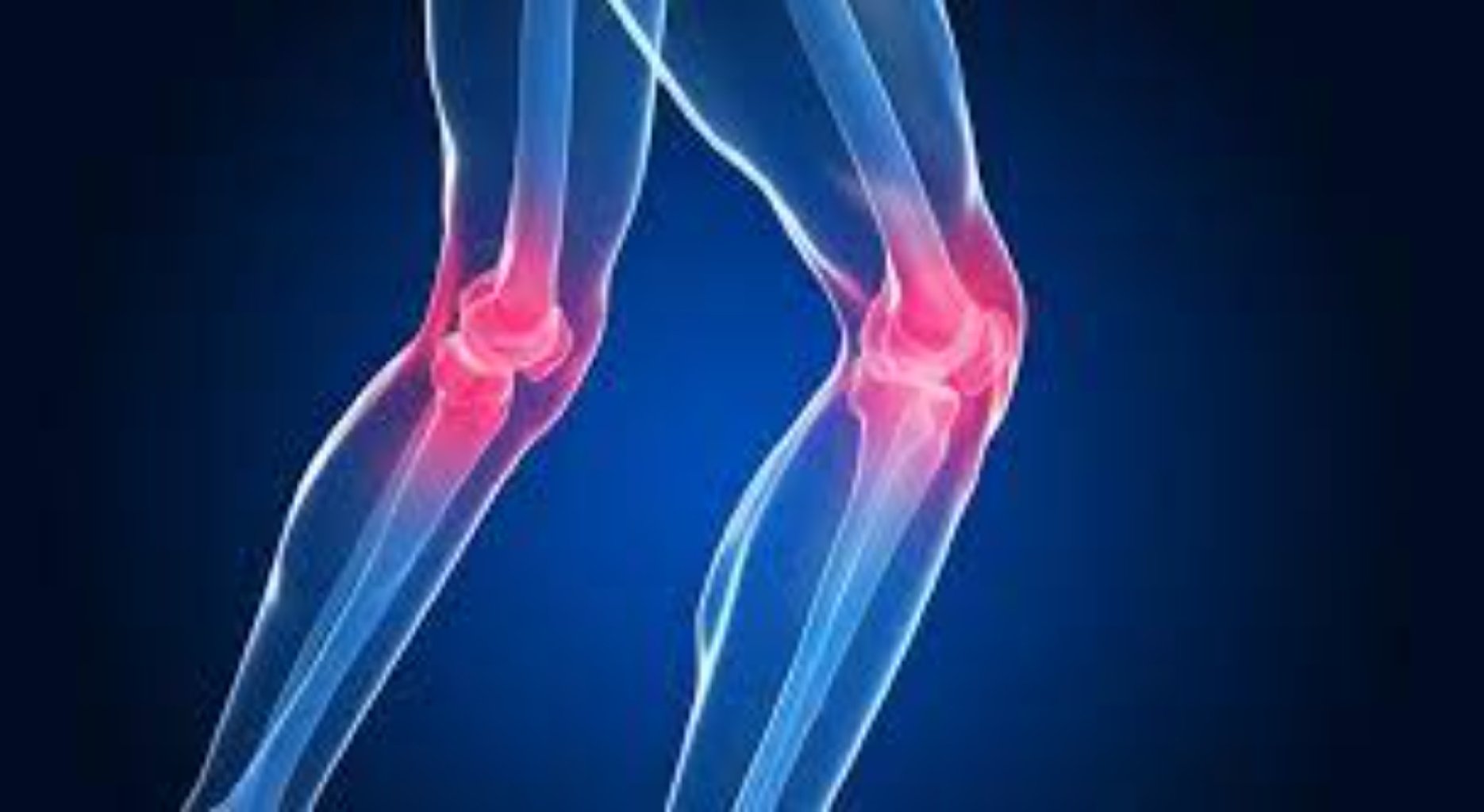 Diz Kirəçləşməsi Müaciləsi