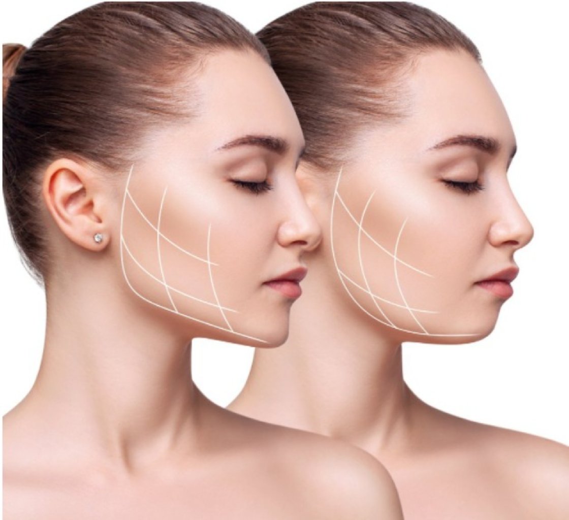 Çənə estetikası və tətbiqi makalesi