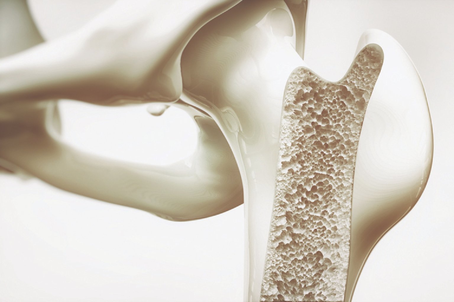 OSTEOPOROZ / OSTEOPOROZ NƏDİR / DİAQNOZ NECƏ QOYULUR?