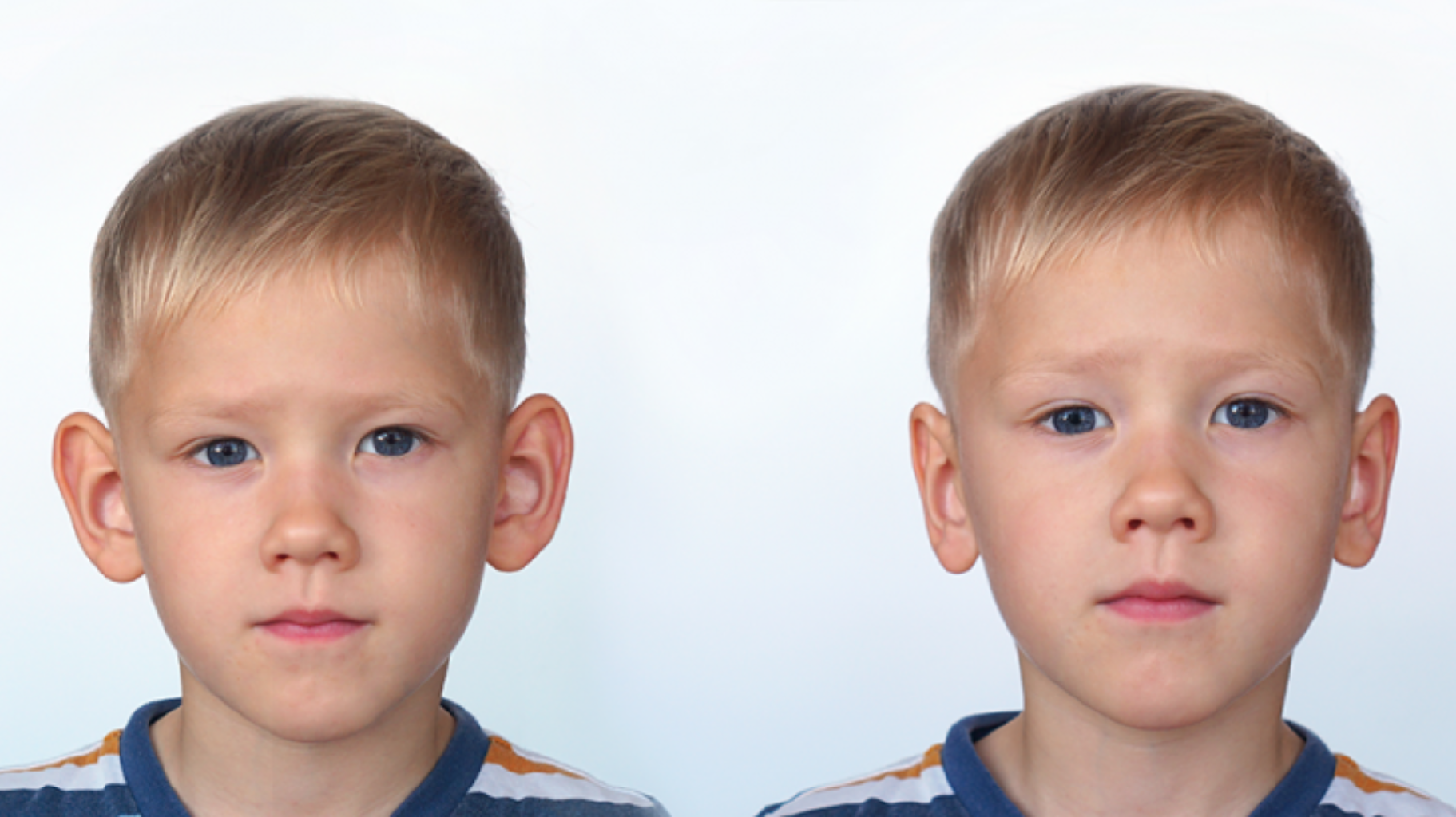 Qulaq Estetikası və Görkəmli Qulaq Problemi makalesi