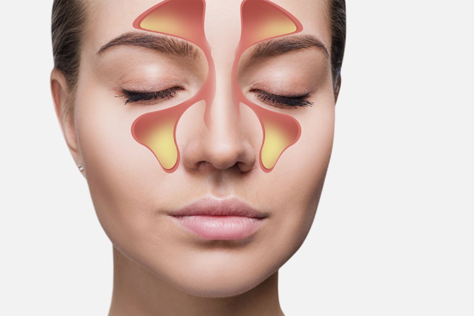 Endoskopik Sinus Cərrahiyyəsi