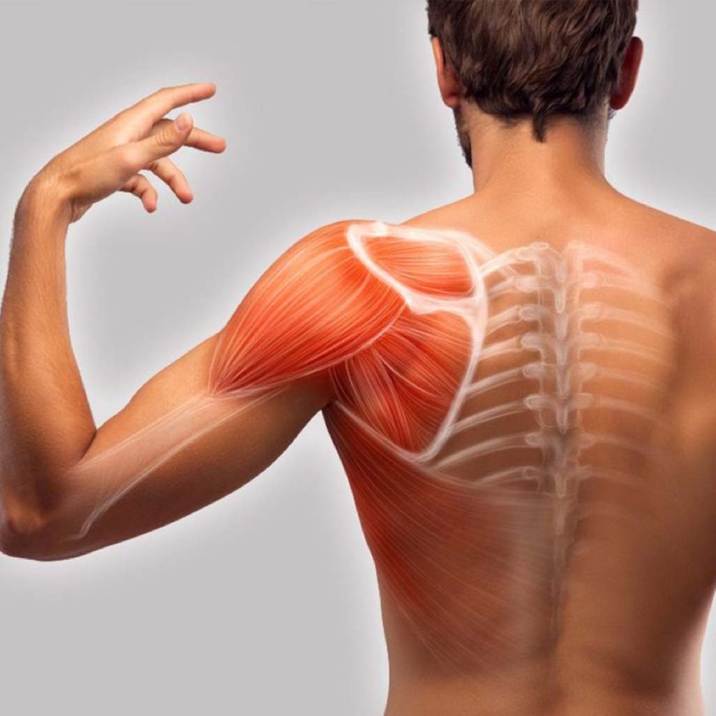 Əzələ ağrıları (fibromialgiya, miofasial ağrılar)