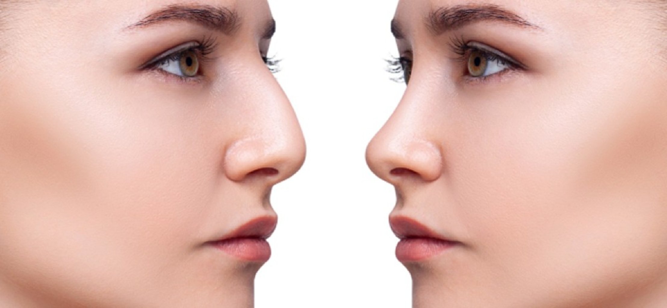 Burun estetikası - Rinoplastika nədir? Cərrahiyyə haqqında hər şey makalesi