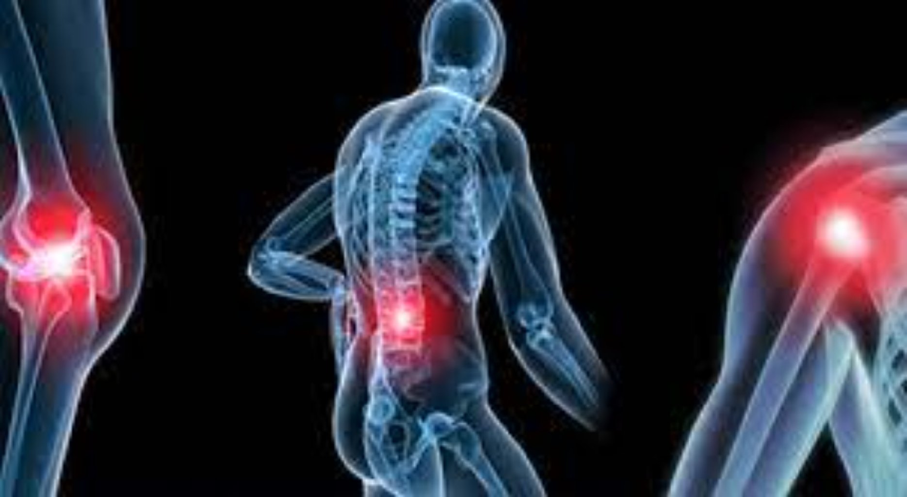 Əhənglənmə (Osteoartrit)